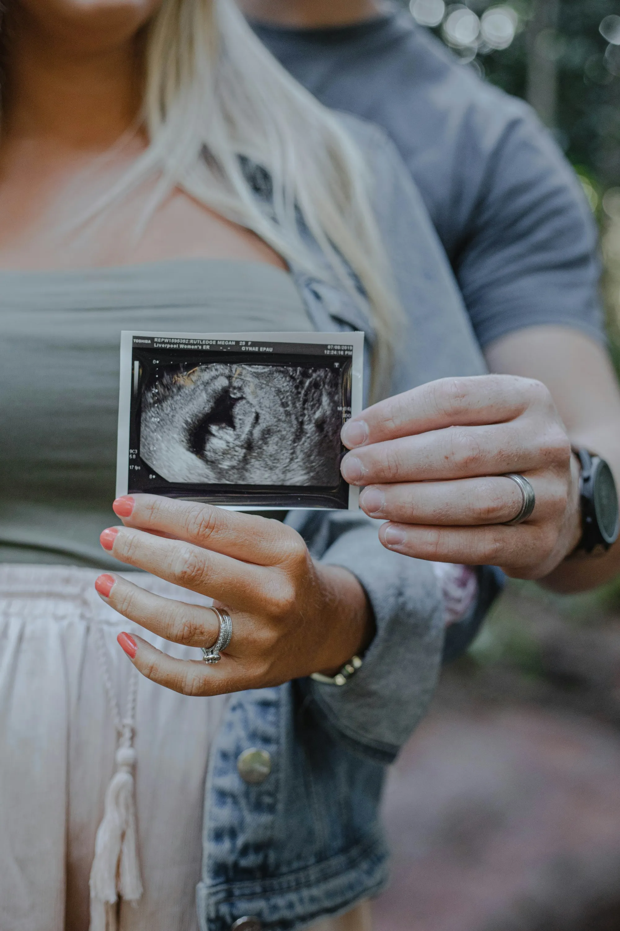 Couple holding up an ultrasound scan of their baby